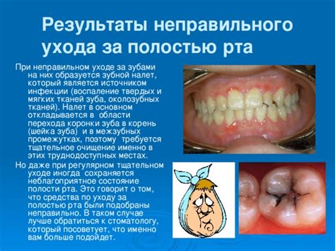 Факторы, ухудшающие состояние при проблемах с полостью рта