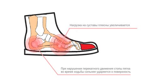 Что предпринять, если стопа выходит из обуви: подсказки и рекомендации