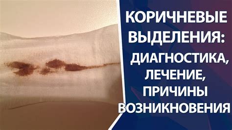 Что такое коричневые выделения у подростков 14 лет: понимание феномена