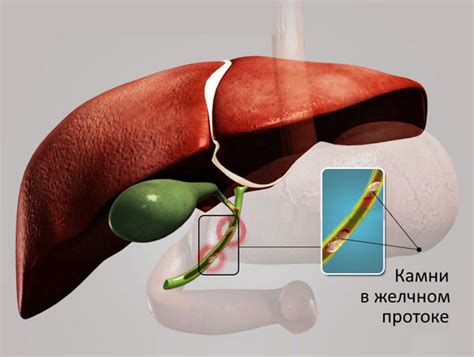  Последствия удаления желчного пузыря для печени 