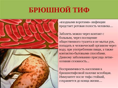  Симптомы, вызываемые инфекцией H bacterium 